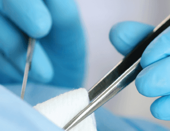 Cirurgia geral - consulta cirurgião geral na médico sem fila